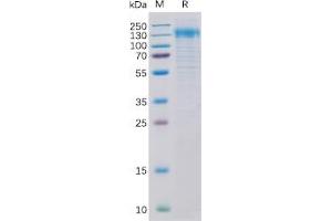 Human Her2 Protein, His Tag on SDS-PAGE under reducing condition. (ErbB2/Her2 Protein (His tag))