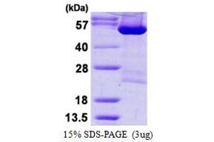 Image no. 1 for Aspartyl-tRNA Synthetase (DARS) protein (His tag) (ABIN1098591) (DARS Protein (His tag))