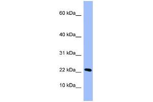 WB Suggested Anti-PIN4 Antibody Titration: 0. (PIN4 antibody  (Middle Region))