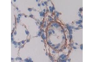 Figure. (ESAM antibody  (AA 31-251))