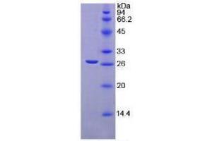SDS-PAGE analysis of Mouse TGFbI Protein. (TGFBI Protein)