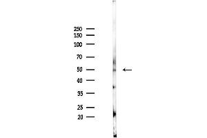 anti-Carbohydrate (Chondroitin 6) Sulfotransferase 3 (CHST3) (C-Term) antibody