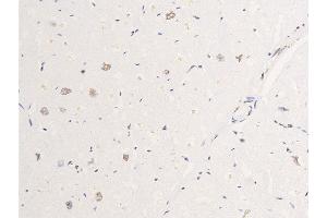 Immunohistochemistry (IHC) image for anti-Epidermal Growth Factor Receptor (EGFR) (pSer695) antibody (ABIN6255471)