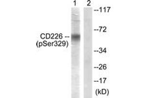 Western blot analysis of extracts from COS7 cells, using CD226/DNAM-1 (Phospho-Ser329) Antibody. (CD226 antibody  (pSer329))