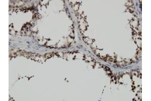 Image no. 1 for anti-PDZ Binding Kinase (PBK) (AA 1-110) antibody (ABIN599272) (PBK antibody  (AA 1-110))
