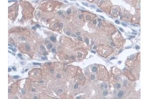 Detection of AST in Human Stomach Tissue using Monoclonal Antibody to Aspartate Aminotransferase (AST)