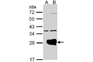 WB Image Western Blot analysis of RAB1A expression in transfected 293T cell line by RAB1A polyclonal antibody. (RAB1A antibody)