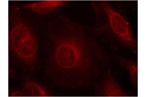 Image no. 2 for anti-V-Akt Murine Thymoma Viral Oncogene Homolog 1 (AKT1) (pTyr312), (pTyr315), (pTyr316) antibody (ABIN319270) (AKT1 antibody  (pTyr312, pTyr315, pTyr316))