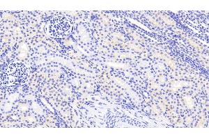 Detection of ACACb in Human Kidney Tissue using Polyclonal Antibody to Acetyl Coenzyme A Carboxylase Beta (ACACb) (Acetyl-CoA Carboxylase beta antibody  (AA 29-249))