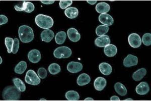 Immunofluorescence staining of HeLa cells (Human cervical epitheloid carcinoma, ATCC CCL-2. (Thymopoietin antibody  (AA 34-156))