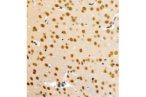 Immunohistochemistry of paraffin embedded mouse brain using HES3 (ABIN7074159) at dilution of 1:1000 (400x lens) (HES3 antibody)