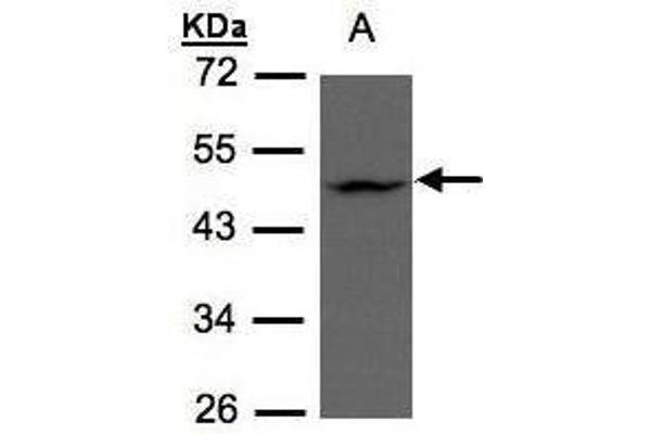 ZDHHC13 antibody  (C-Term)