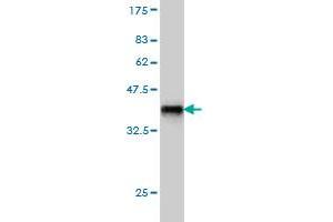 Western Blot detection against Immunogen (36. (INPPL1 antibody  (AA 1159-1258))