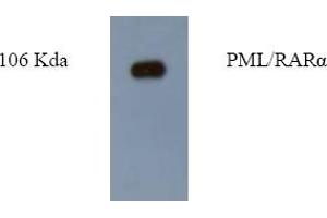 Western Blotting (WB) image for anti-Promyelocytic Leukemia (PML) antibody (ABIN452172) (PML antibody)