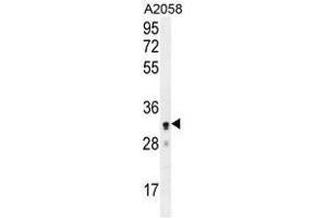 UBXN2A Antibody (C-term) western blot analysis in A2058 cell line lysates (35 µg/lane). (UBXN2A antibody  (C-Term))
