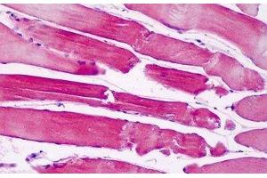 Human Skeletal Muscle: Formalin-Fixed, Paraffin-Embedded (FFPE) (PAK6 antibody  (AA 268-297))