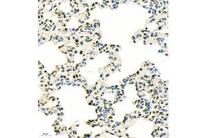 Immunohistochemistry of paraffin embedded rat lung using SUV39H1 (ABIN7075770) at dilution of 1:500 (400x lens) (SUV39H1 antibody)
