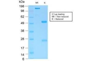 SDS-PAGE analysis of purified, BSA-free recombinant Gastric Mucin antibody (clone MUC6/1553R) as confirmation of integrity and purity. (MUC6 antibody)