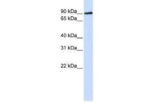 Western Blotting (WB) image for anti-DNA Cross-Link Repair 1C (DCLRE1C) antibody (ABIN2459465) (DCLRE1C antibody)