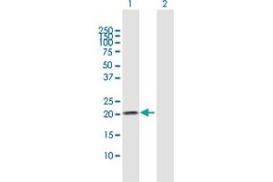 Western Blot analysis of N6AMT1 expression in transfected 293T cell line by N6AMT1 MaxPab polyclonal antibody. (N6AMT1 antibody  (AA 1-186))