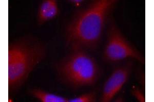 Immunofluorescence staining of methanol-fixed Hela cells using MARCKS(Phospho-Ser158) Antibody. (MARCKS antibody  (pSer158))
