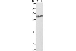 Western Blotting (WB) image for anti-Aminolevulinate, delta-, Synthase 2 (ALAS2) antibody (ABIN2422513) (ALAS2 antibody)