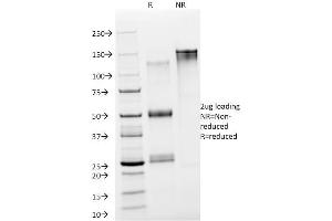 SDS-PAGE Analysis Purified NSE gamma Mouse Monoclonal Antibody (NSE-P2). (ENO2/NSE antibody  (AA 416-433))
