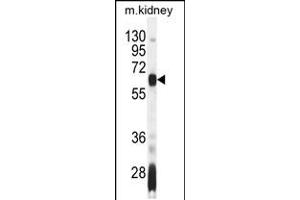 Western blot analysis in mouse kidney tissue lysates (35ug/lane). (AIRE antibody  (AA 64-92))