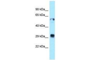 Image no. 1 for anti-Thioredoxin-Related Transmembrane Protein 1 (TMX1) (C-Term) antibody (ABIN6747966)