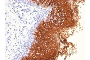 Formalin-fixed, paraffin-embedded human Skin stained with Cytokeratin 10 Mouse Monoclonal Antibody (AE20). (Keratin 10 antibody)