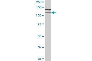 BCOR MaxPab polyclonal antibody. (BCOR antibody  (AA 1-1004))