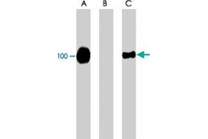 Western blot of Jurkat cells expressing CFL1. (Cofilin antibody  (pSer3))