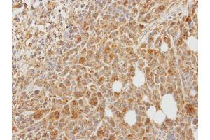 IHC-P Image Immunohistochemical analysis of paraffin-embedded SAS xenograft, using PCPE-1, antibody at 1:100 dilution. (PCOLCE antibody)