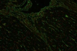Immunohistochemistry staining (paraffin sections) of vimentin in human liver using mouse monoclonal antibody VI-RE/1 ((ABIN94494), diluted 1:400), detected with GAM IgG-Alexa Fluor488 (diluted 1:200, green), cell nuclei stained with PI (1 μg/mL, orange). (Vimentin antibody)