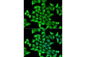 Immunofluorescence analysis of HeLa cells using SEPSECS antibody. (SEPSECS antibody)