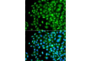 Immunofluorescence analysis of A549 cell using PAK2 antibody. (PAK2 antibody)
