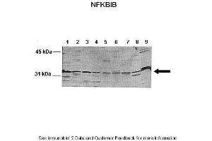 Lanes:   Lane 1: 100ug mouse liver lysate  Lane 2: 100ug mouse brain lysate  Lane 3: 100ug mouse heart lysate  Lane 4: 100ug mouse kidney lysate  Lane 5: 100ug mouse lung lysate  Lane 6: 100ug mouse thymus lysate  Lane 7: 100ug mouse spleen lysate  Lane 8: 100ug mouse testis lysate  Lane 9: 100ug HeLa cell lysate   Primary Antibody Dilution:   1:1000  Secondary Antibody:   Anti-rabbit-AP  Secondary Antibody Dilution:   1:10,000  Gene Name:   NFKBIB  Submitted by:   Andreia Carvalho. (NFKBIB antibody  (N-Term))