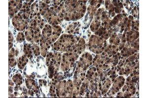 Image no. 2 for anti-Mannose Phosphate Isomerase (MPI) antibody (ABIN1499543) (MPI antibody)