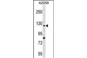 Western blot analysis in A2058 cell line lysates (35ug/lane). (PTPRN2 antibody  (N-Term))
