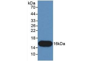 Detection of Recombinant CTGF, Human using Monoclonal Antibody to Connective Tissue Growth Factor (CTGF) (CTGF antibody  (AA 80-200))