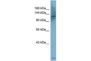 WB Suggested Anti-PLCB1  Antibody Titration: 0. (Phospholipase C beta 1 antibody  (Middle Region))