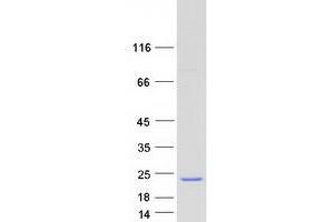 Validation with Western Blot (MED21 Protein (Myc-DYKDDDDK Tag))