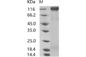 Western Blotting (WB) image for Human Immunodeficiency Virus ENV (HIV-1 gp160) protein (His tag) (ABIN7196111) (HIV-1 gp160 Protein (His tag))