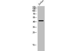 Western Blot analysis of Jurkat cells using Cleaved-Thrombin R (S42) Polyclonal Antibody (PAR1 antibody  (Cleaved-Ser42))