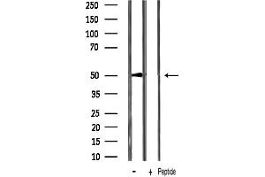 Western blot analysis of p53 phosphorylation expression in rat muscle lysates,The lane on the right was treated with the antigen-specific peptide.