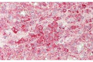 Detection of SIGLEC7 in Human Spleen Tissue using Polyclonal Antibody to Sialic Acid Binding Ig Like Lectin 7 (SIGLEC7) (SIGLEC7 antibody  (AA 38-121))