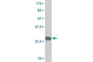 Western Blot detection against Immunogen (36. (LIM Domain Kinase 1 antibody  (AA 548-647))
