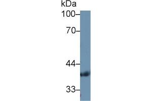 Western Blotting (WB) image for anti-Pyruvate Dehydrogenase beta (PDHB) (AA 31-341) antibody (ABIN7434347)