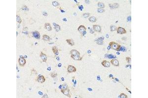 Immunohistochemistry of paraffin-embedded Rat brain using DLG1 Polyclonal Antibody at dilution of 1:100 (40x lens). (DLG1 antibody)