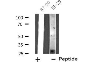 Western blot analysis of extracts from HT-29 cells, using ZFYVE19 antibody.